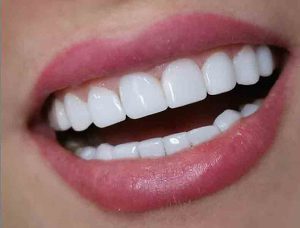 سفید کردن