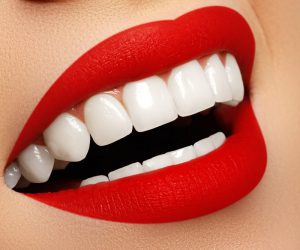 کامپوزیت و لمینت