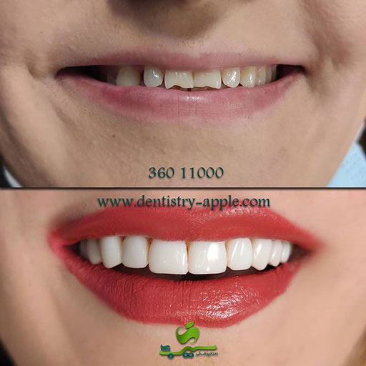 نمونه کار بیمار خانم ۳۸ ساله