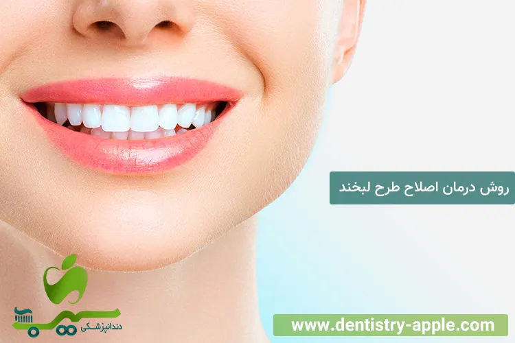 روش درمان اصلاح طرح لبخند