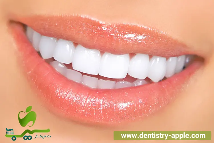 روکش دندان دارای چه مراحلی است