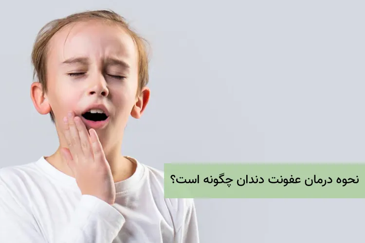 نحوه درمان عفونت دندان چگونه است