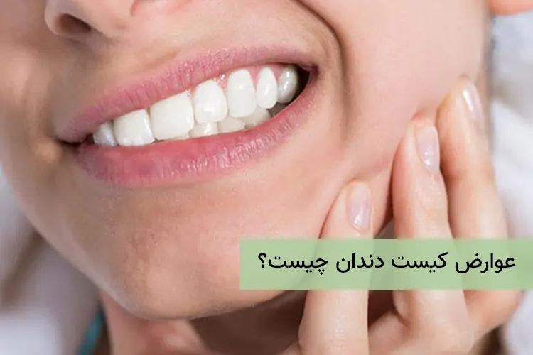 عوارض کیست دندان چیست