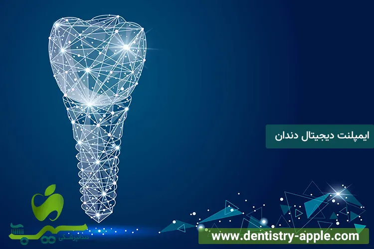ایمپلنت دیجیتال دندان