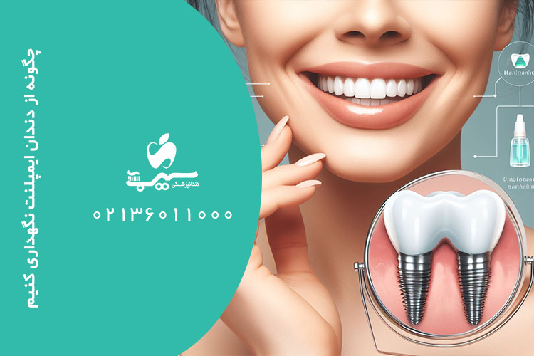 چگونه از دندان ایمپلنت نگهداری کنیم