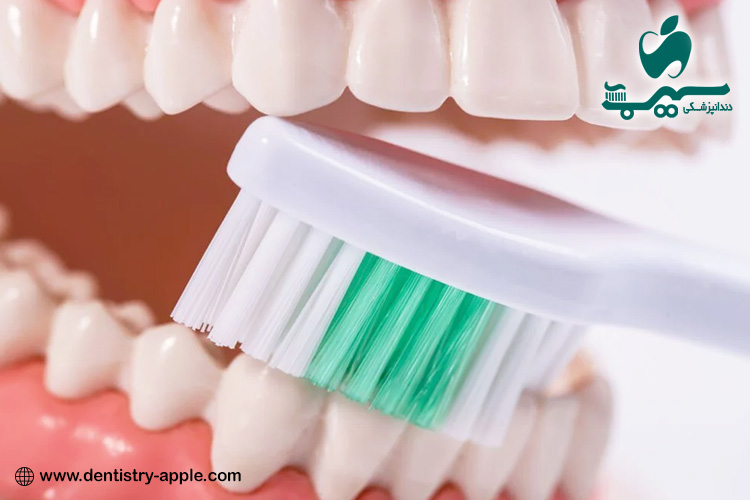استفاده از پروتزهای متحرک
