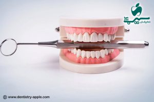 استفاده از پروتزهای متحرک