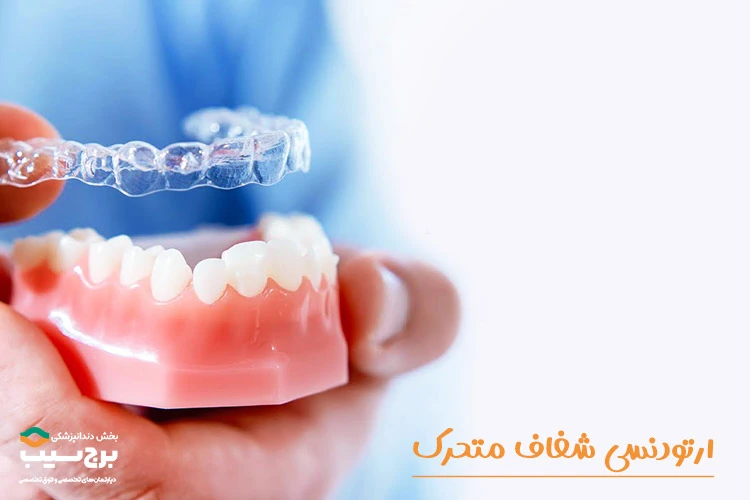 ارتودنسی شفاف متحرک