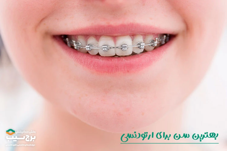 بهترین سن برای ارتودنسی