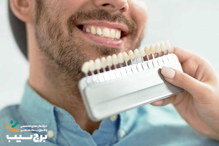 لمینت کامپوزیتی
