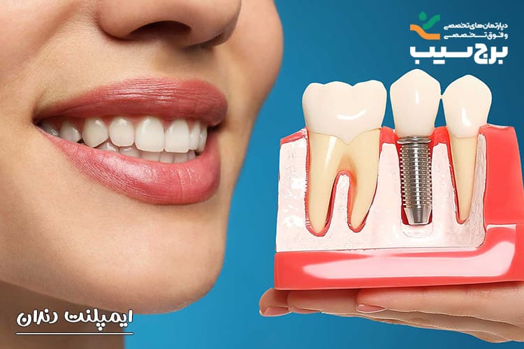 مراقبت از ایمپلنت دندان