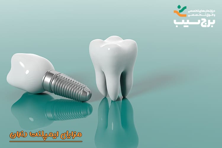 مزایای ایمپلنت دندان