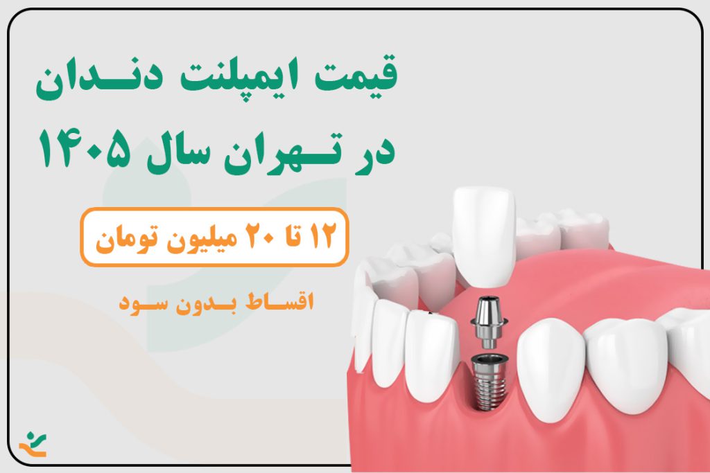 قیمت ایمپلنت دندان تهران